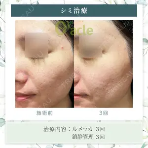オラクル美容皮膚科 東京新宿院の症例