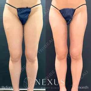 NEXUS CLINICの症例