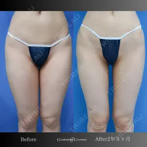 ガーデンクリニック 池袋院の症例
