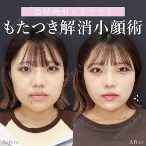 症例