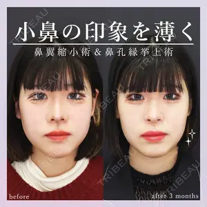 症例