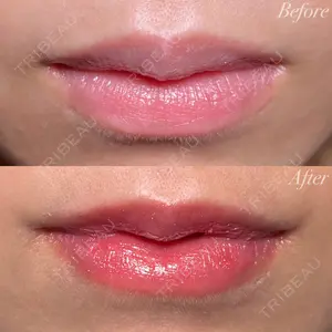 R Beauty CLINIC 銀座院 村山史朗医師の症例