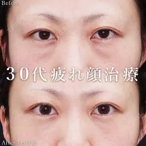 症例