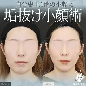 症例