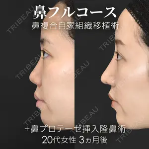 ジョウクリニック 銀座院 重本　譲医師の症例