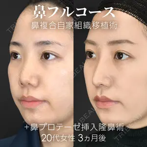 ジョウクリニック 銀座院 重本　譲医師の症例