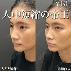 YBC横浜美容外科 大宮院 磯村 亮輔医師の症例