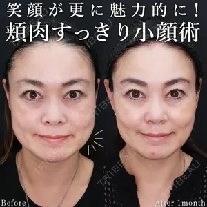 症例