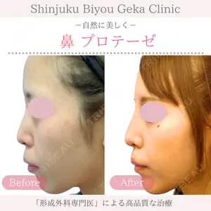 新宿美容外科クリニック 新宿院 井上 淳医師の症例