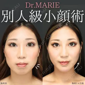 症例