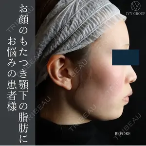 吉祥寺アイビークリニックの症例