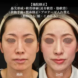シンデレラ＆ダヴィンチクリニック 宮田 洋佑医師の症例