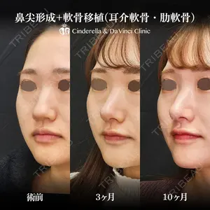 シンデレラ＆ダヴィンチクリニック 宮田 洋佑医師の症例