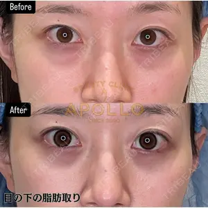APOLLO BEAUTY CLINIC 鬼沢 正道医師の症例