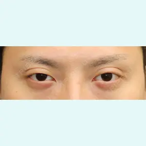 プリモ麻布十番クリニック 大場教弘医師の症例