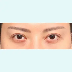 プリモ麻布十番クリニック 大場教弘医師の症例