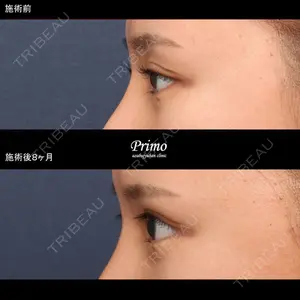 プリモ麻布十番クリニック 大場教弘医師の症例