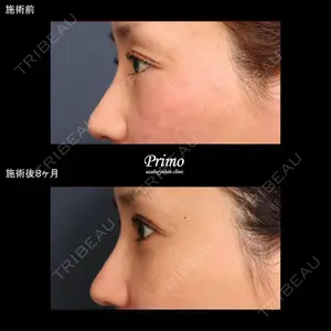 プリモ麻布十番クリニック 大場教弘医師の症例
