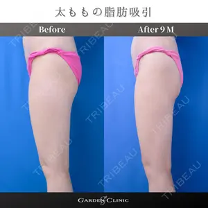 ガーデンクリニック 池袋院の症例