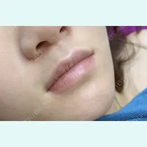 しんゆり美容健康クリニックの症例