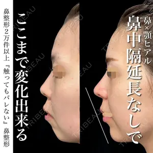 グローバルビューティークリニック 銀座院 理事長　杉崎　裕斗医師の症例
