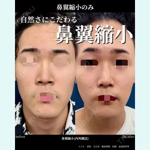 グローバルビューティークリニック 大阪院の症例