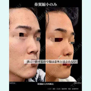 グローバルビューティークリニック 大阪院の症例