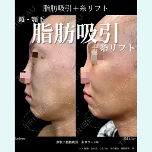 グローバルビューティークリニック 大阪院の症例