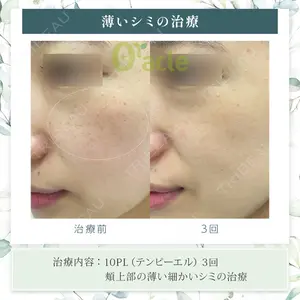 オラクル美容皮膚科 東京新宿院の症例