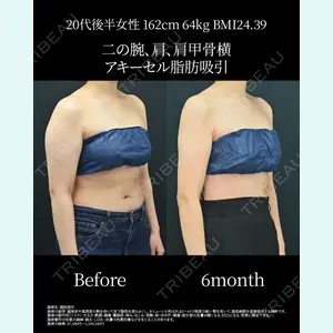 湘南美容クリニック 名古屋院 山本 高士医師の症例