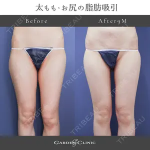 ガーデンクリニック 池袋院の症例