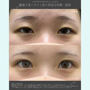 湘南美容クリニック 名古屋栄院の症例