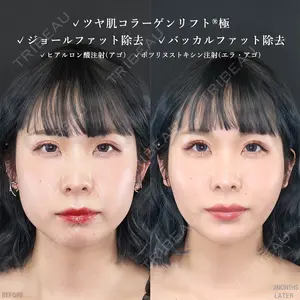 症例