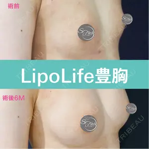 症例