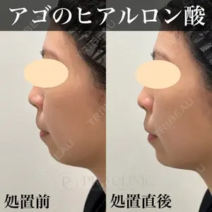 症例