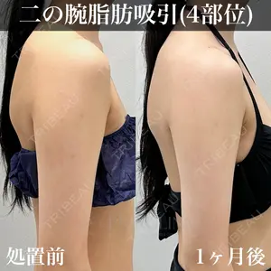 症例