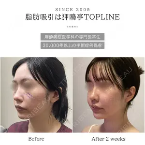 狎鴎亭トップライン医院の症例