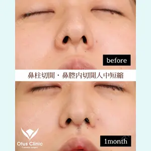 Otus Clinic 【オータスクリニック】 中 徳太郎医師の症例