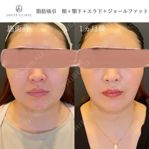 小松 塁医師の症例