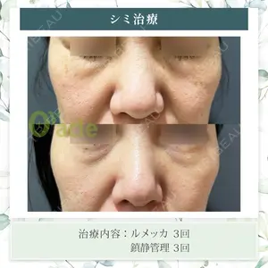 オラクル美容皮膚科 東京新宿院の症例