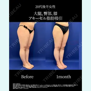 湘南美容クリニック 名古屋院 山本 高士医師の症例