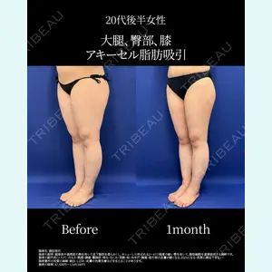 湘南美容クリニック 名古屋院 山本 高士医師の症例