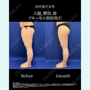 湘南美容クリニック 名古屋院 山本 高士医師の症例