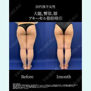 湘南美容クリニック 名古屋院 山本 高士医師の症例