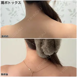 症例