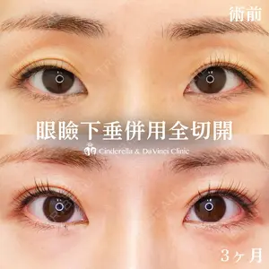 シンデレラ＆ダヴィンチクリニック 宮田 洋佑医師の症例