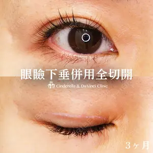 シンデレラ＆ダヴィンチクリニック 宮田 洋佑医師の症例