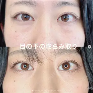 症例