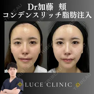 ルーチェクリニック 銀座院 加藤晴之輔医師の症例