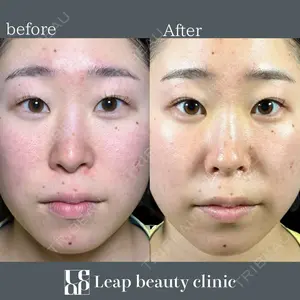 Leap beauty clinic 土門 駿也医師の症例